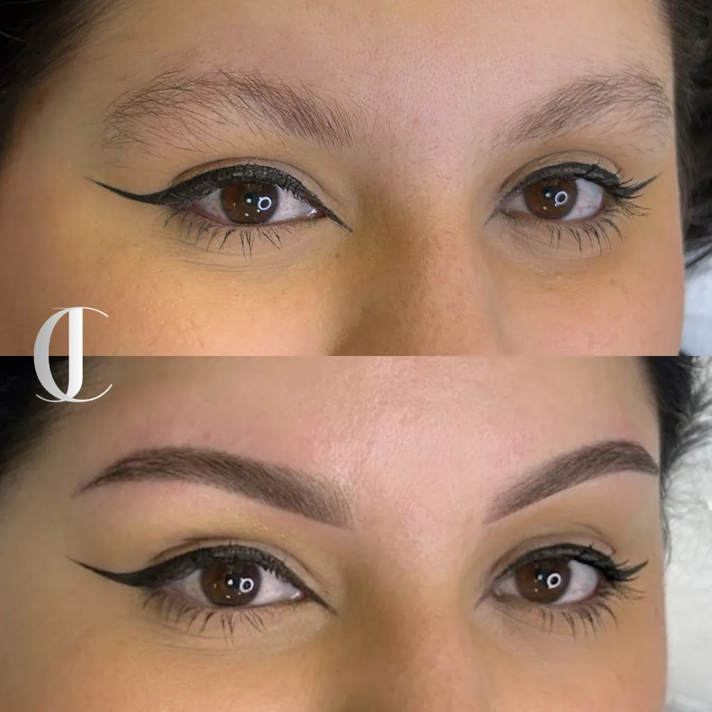 Antes e depois de micropigmentação de sobrancelha