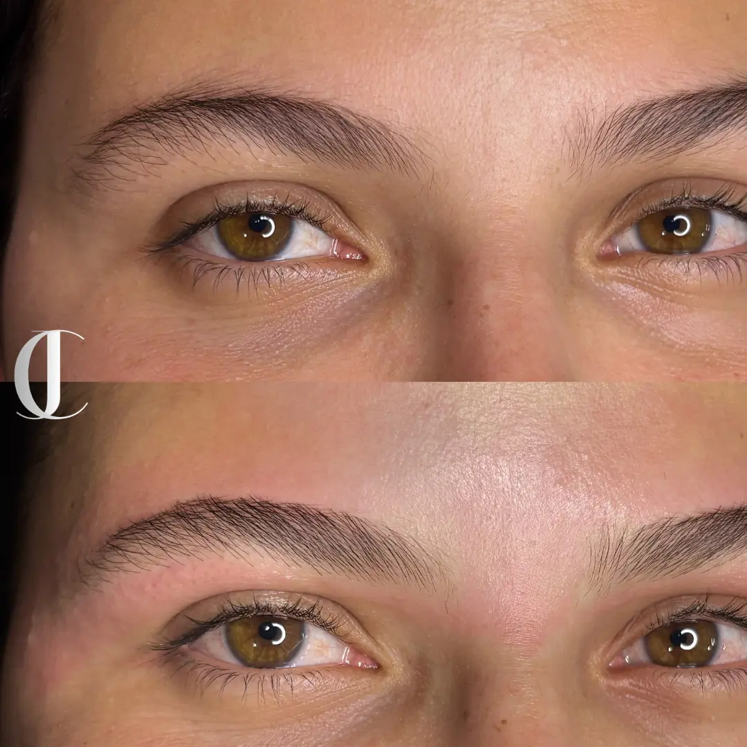 Antes e depois de Design Personalizado