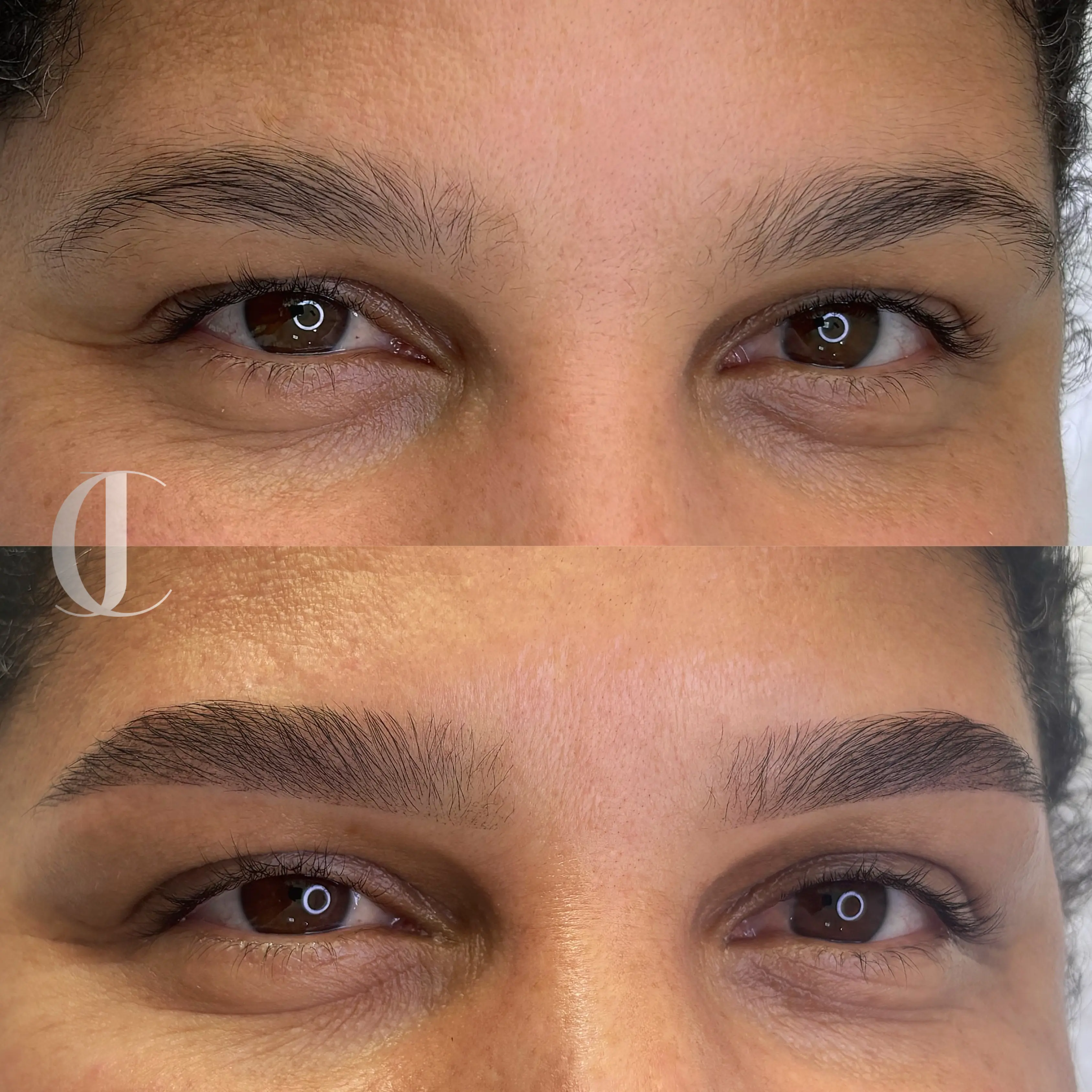Antes e depois de micropigmentação de sobrancelha