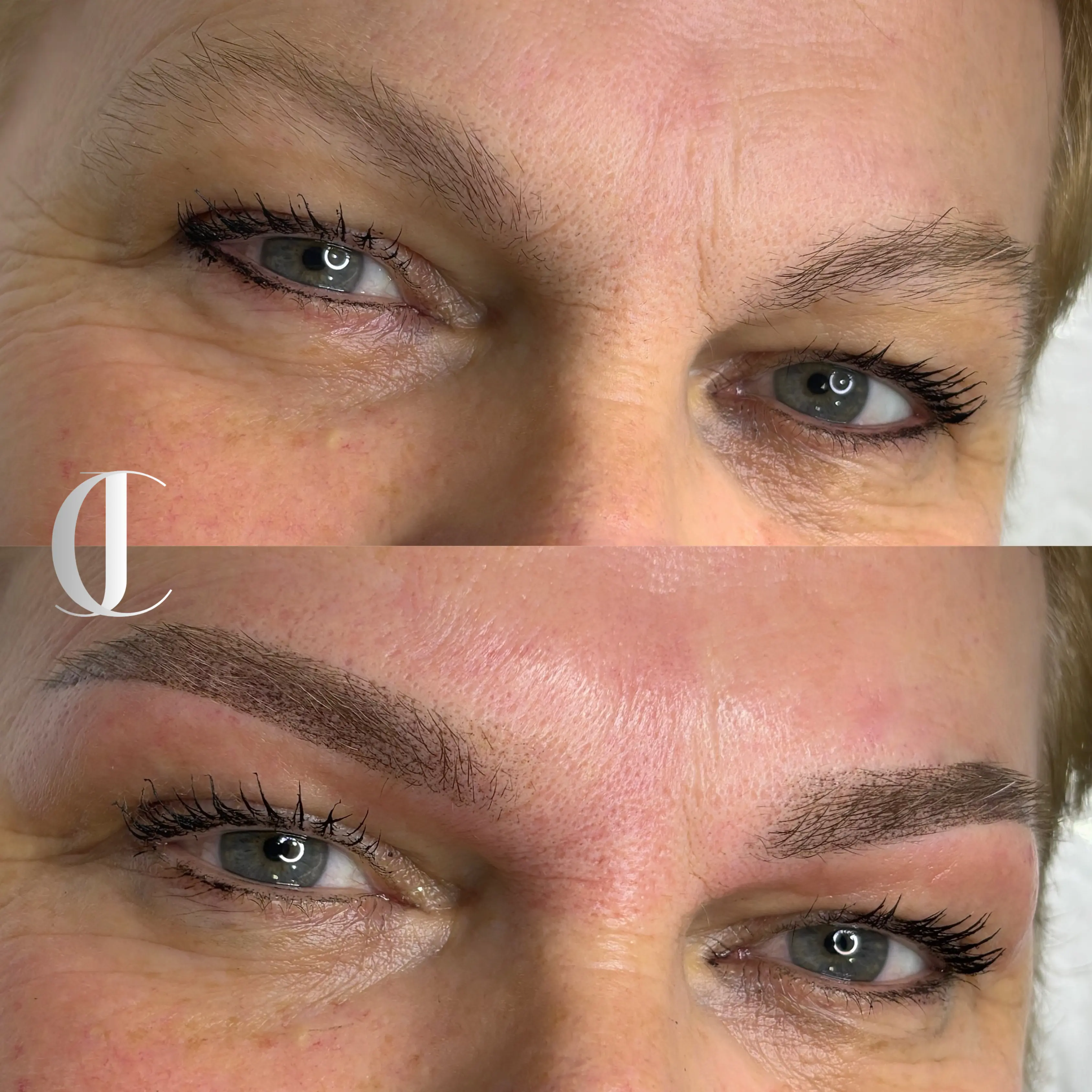 Antes e depois de Micropigmentação Sombreada